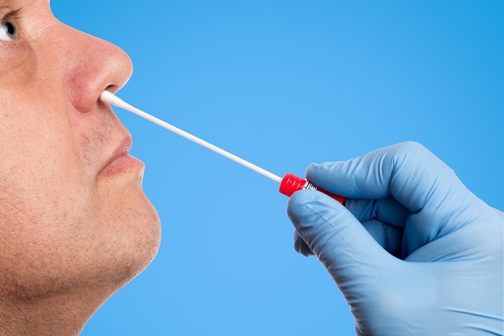 Test diagnostici SARS-CoV-2 -- Tampone al naso covid19